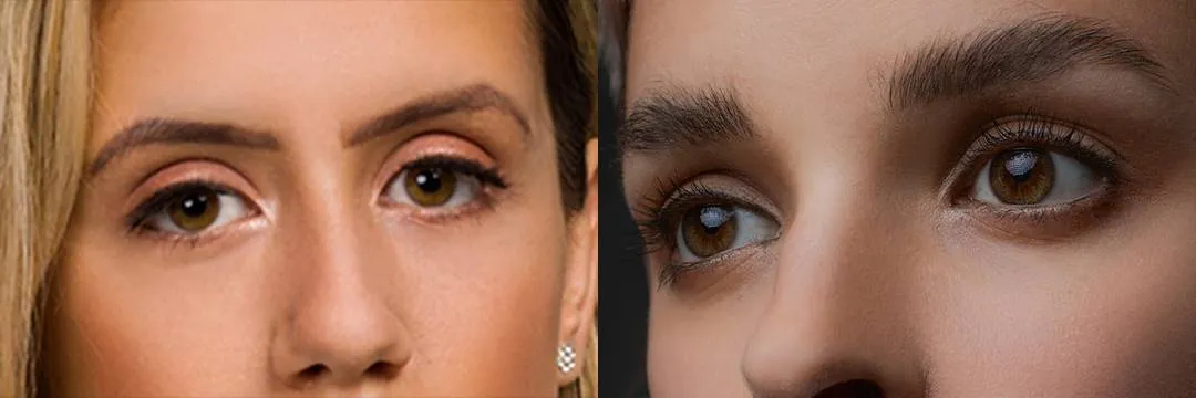 کچ لایت چیست