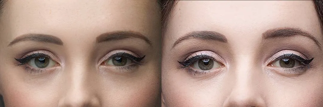 کچ لایت چیست